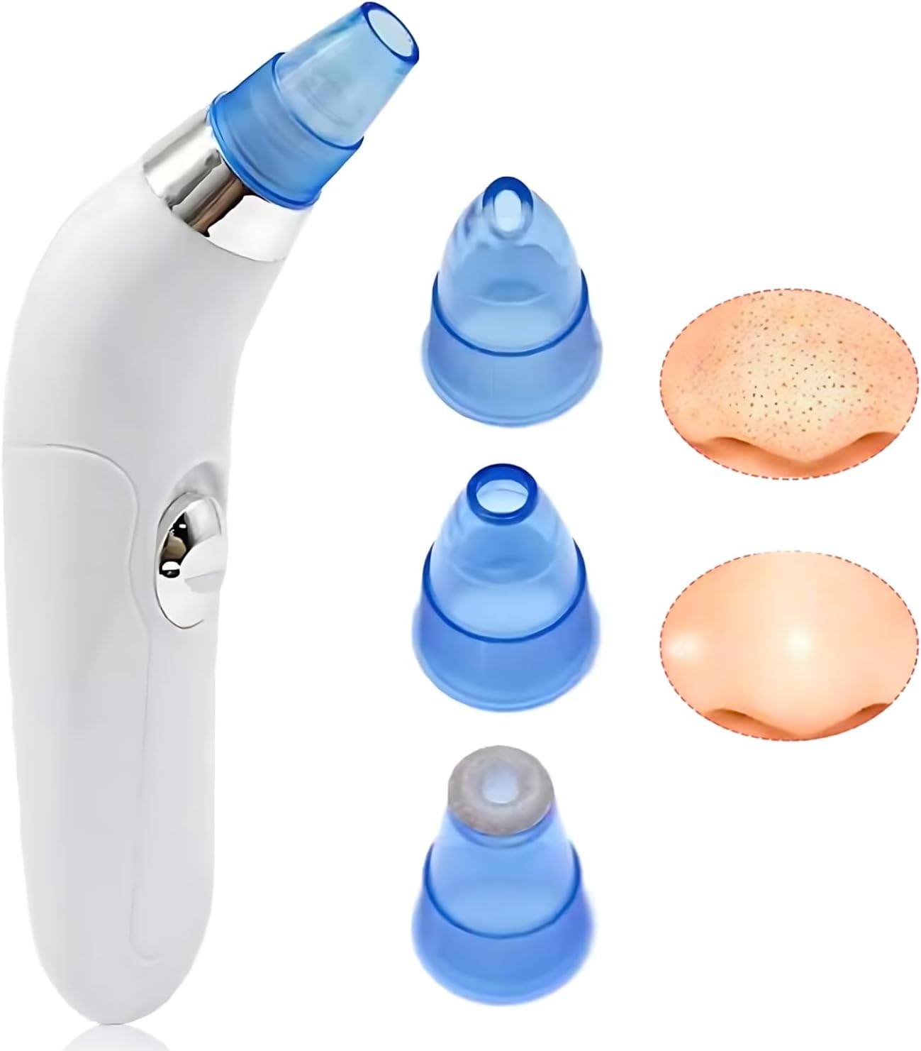 Pore Cleaning Device🔋 USB Rechargeable 🔋