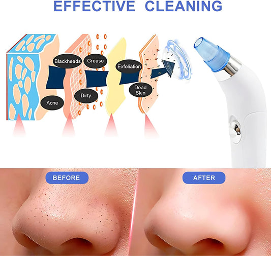 Pore Cleaning Device🔋 USB Rechargeable 🔋